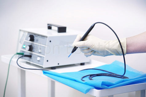 Удаление новообразований аппаратом Сургитрон!