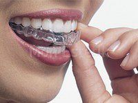 Улыбайтесь уверенно с Invisalign!